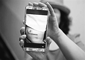 家长花6万送孩子学艺 百余学生被曝遭老师钢棍打(图1) 家长花6万送孩子学艺 百余学生被曝遭老师钢棍打(图1)